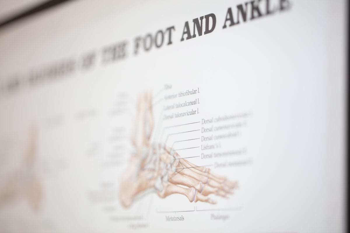 chart used by our newport beach podiatrist