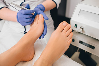 patient during treatment for toenail fungus treatment in Anaheim