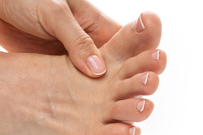 Toes after ingrown toenail treatment in Anaheim and Newport Beach