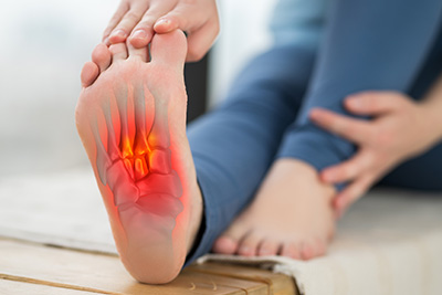 illustration showing plantar fasciitis treatment in Anaheim and Newport Beach